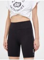 Kraťasy Dkny dámské, černá barva, s aplikací, high waist